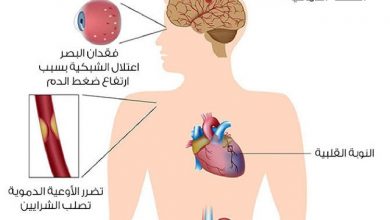 أعراض ارتفاع ضغط الدم العصبي