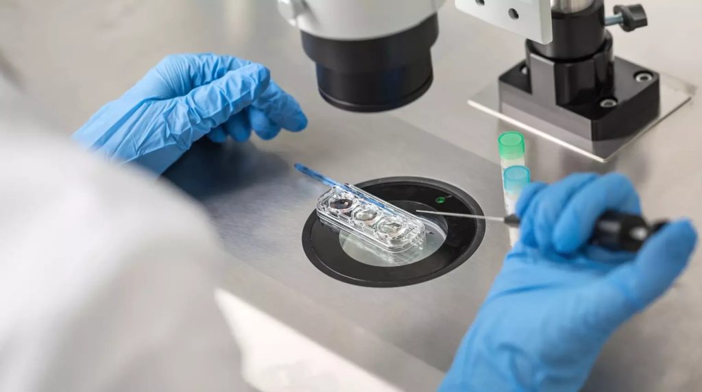 تكلفة الحقن المجهري في مصر